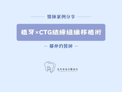 【前牙美學救援】牙齒斷裂怎麼辦？