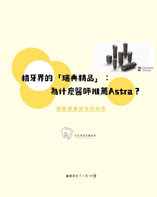 【植牙界的瑞典精品 ╳ 完整流程全攻略!一張圖看懂為什麼醫師一致推薦 Astra?】 【植牙界的瑞典精品 ╳ 完整流程全攻略!一張圖看懂為什麼醫師一致推薦 Astra?】